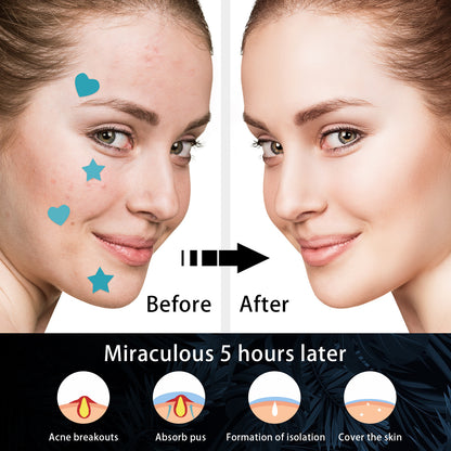 ClearSkin Acne Patch – Remove Pimples Overnight