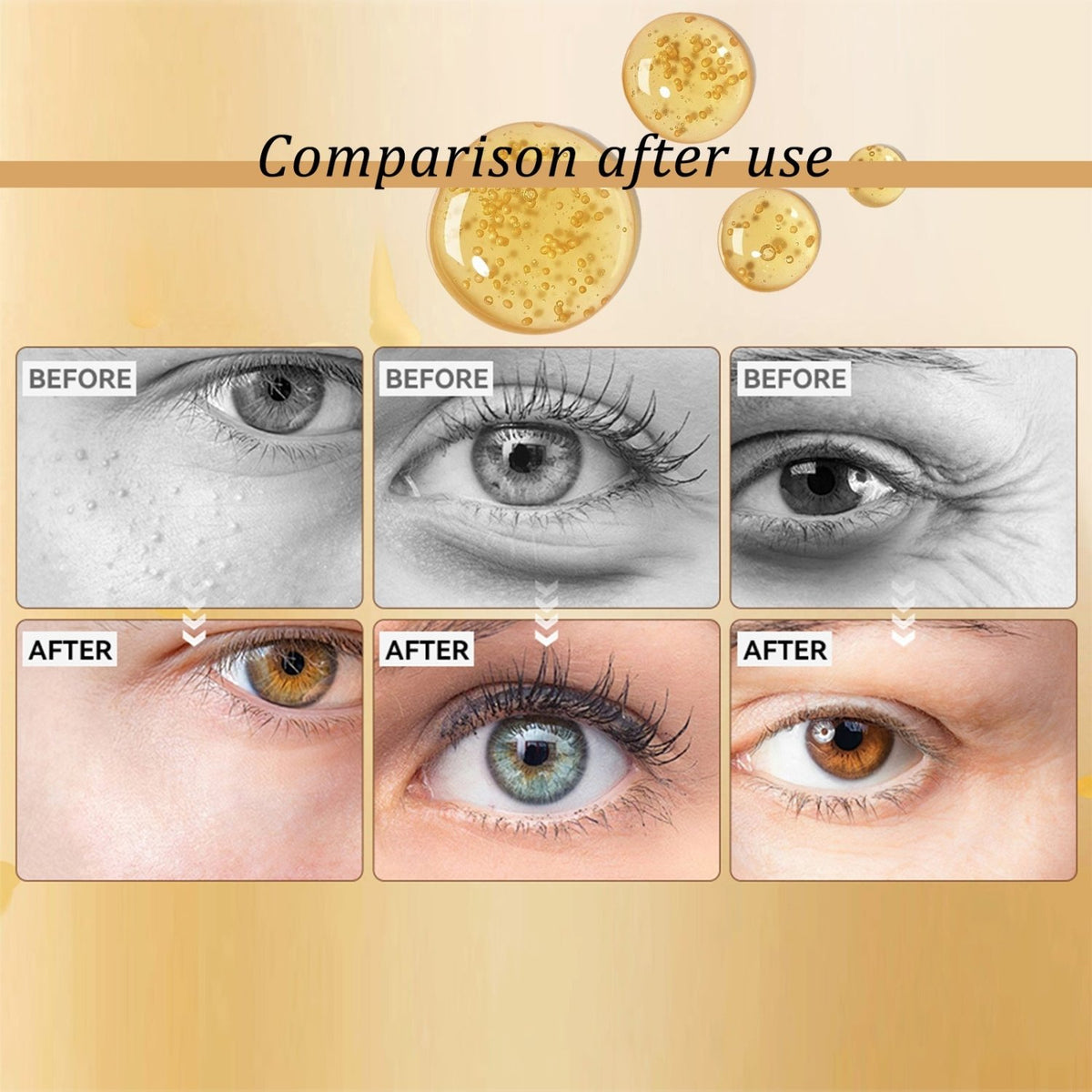HOYGI Snail Peptide Eye Cream before-and-after eye-area comparison graphic