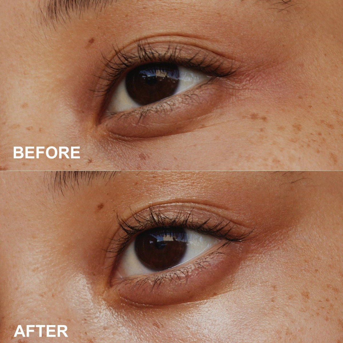 Before-and-after style close-up comparison of the skin around an eye