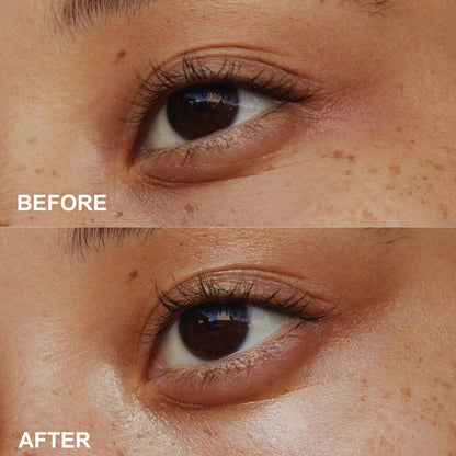 Before-and-after style close-up comparison of the skin around an eye